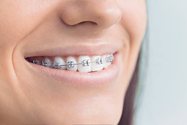 Best Tooth Extraction  in Laguna Park, TX